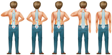 Diagram showing human man with back pain illustrationのイラスト素材