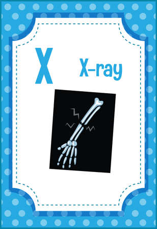 Alphabet flashcard with letter X for X-ray illustrationのイラスト素材