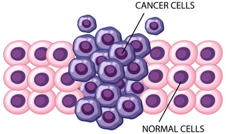 Process of cancer cell development illustrationのイラスト素材