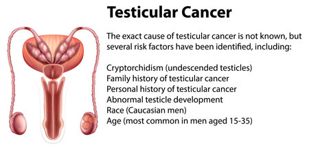 Testicular Cancer infographic with explanation illustration