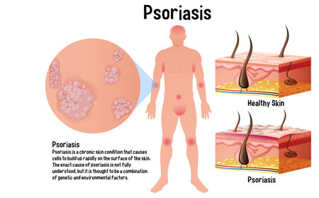 Human skin conditions infographic with explanation illustrationのイラスト素材