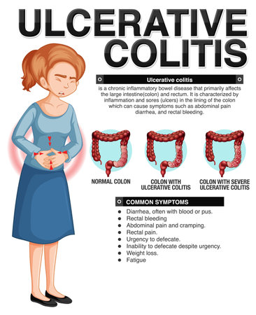 Ulcerative Colitis Symptoms Infographic illustrationのイラスト素材