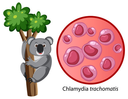 Chlamydia trachomatis with explanation illustrationのイラスト素材