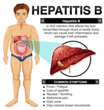 Symptoms of Hepatitis B Infographic illustrationのイラスト素材