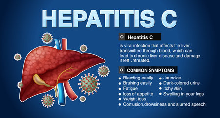 Symptoms of Hepatitis C Infographic illustrationのイラスト素材