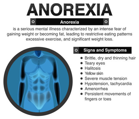 Anorexia (Anorexia) and Its Effects on the Body illustrationのイラスト素材