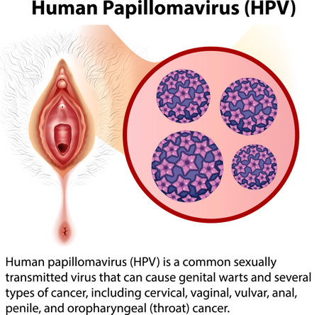 Human Papillomavirus with explanation illustrationのイラスト素材