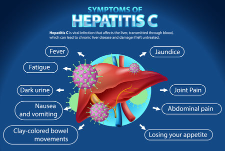 Informative Symptoms of Hepatitis C illustrationのイラスト素材