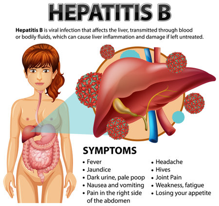 Symptoms of Hepatitis B illustrationのイラスト素材