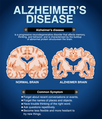 Informative poster of Alzheimers disease illustrationのイラスト素材