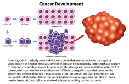 Cancer Development vector with information illustrationのイラスト素材