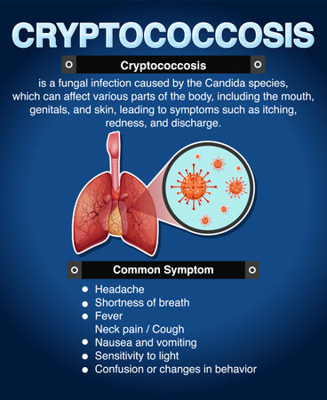Informative poster of Cryptococcosis illustrationのイラスト素材
