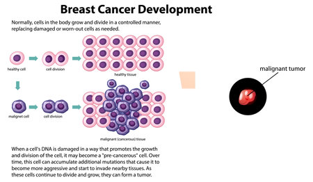 Cancer Development vector with information illustrationのイラスト素材