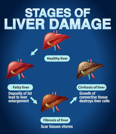 Stages of Liver Damage Infographic illustrationのイラスト素材