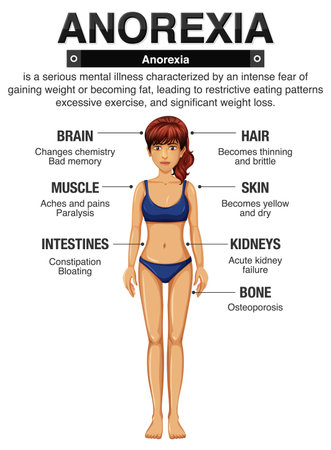 Anorexia (Anorexia) and Its Effects on the Body illustrationのイラスト素材