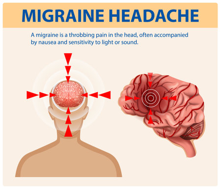 Illustration of migraine pain and brain anatomyのイラスト素材