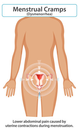 Illustration of menstrual cramps and uterine contractionsのイラスト素材