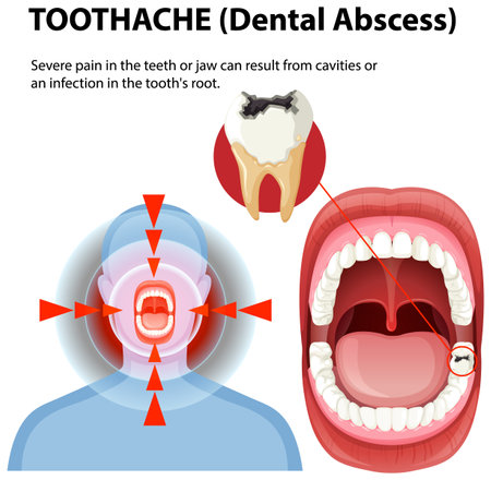 Illustration of toothache causes and symptomsのイラスト素材