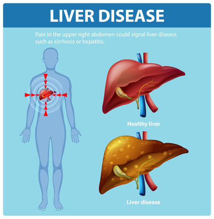 Illustration of healthy and diseased liver comparisonのイラスト素材
