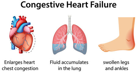 Vector illustration showing heart, lungs, and swollen foot. Highlights symptoms of congestive heart failure with clear, educational visualsのイラスト素材