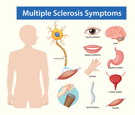 Educational vector diagram highlighting multiple sclerosis symptoms with labeled organs, nerves, and body systems in a clean, flat medical styleのイラスト素材