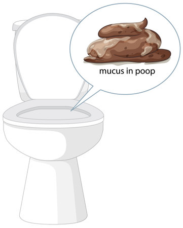 Vector illustration of a toilet with a focus on stool containing mucus, highlighting medical concernsのイラスト素材