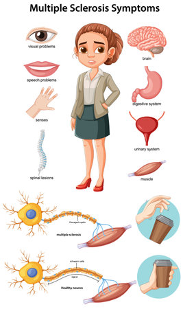 Educational vector diagram showing multiple sclerosis symptoms, affected body systems, nerve cell...