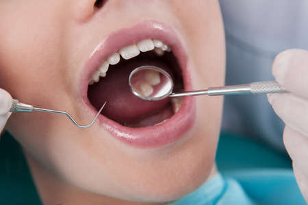 Patient at dentist office. Close-up of little girl sitting at the chair in dental office and keeping mouth openの写真素材