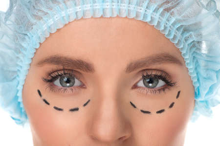 Plastic surgery. Cropped image of female face with marks on it isolated on whiteの写真素材