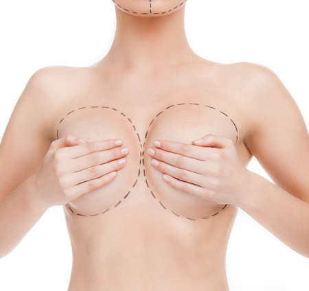Body improving. Cropped image of female body with marks around breastの写真素材