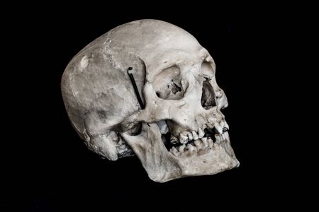 real human skull side viewの写真素材