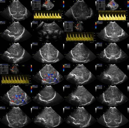 composition of detail ultrasound pictures from ultrasound examinationの写真素材