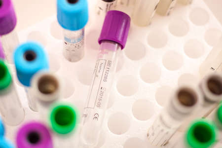 Vaccum tube for testing in Lab Testingの写真素材