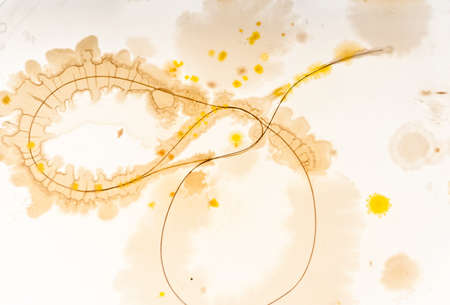 Curved human hairs on an agar petrie dish showing colonies of bacteria growing off them 