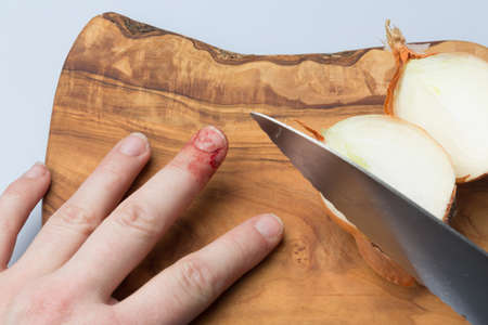 finger with a deep cut bleeding showing knife accidentの写真素材