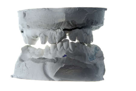 Plaster teeth cast isolated on whiteの写真素材