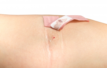 Plaster on the crook, after donating bloodの写真素材