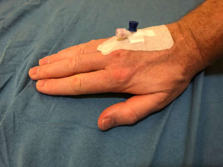 A cannula is stuck in a vein in one hand.