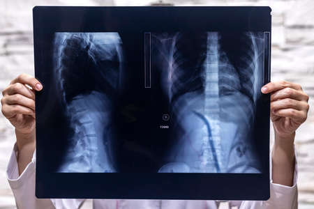 Doctor watching a patient x-ray in hospital. Medical and health care concept.
