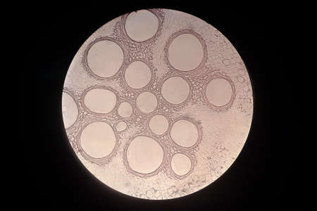 Cross sections of the plant root under microscope view.