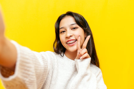 young happy asian woman with braces taking selfie and showing peace gesture on yellow isolated background, korean girl video chatting and greetingの写真素材