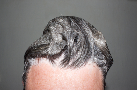 Hair caused by shampooの写真素材