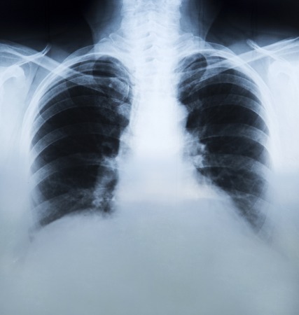 X rey recordingの写真素材