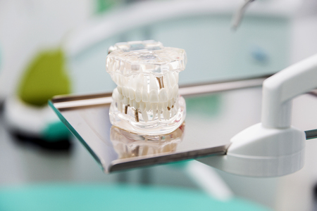 View at model dentures in dental office