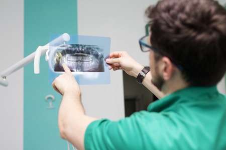 Dentist analyzing x-ray of teethの写真素材