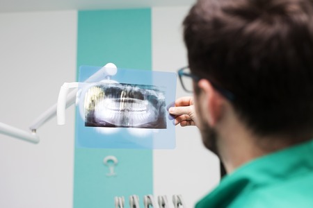 Dentist analyzing x-ray of teethの写真素材