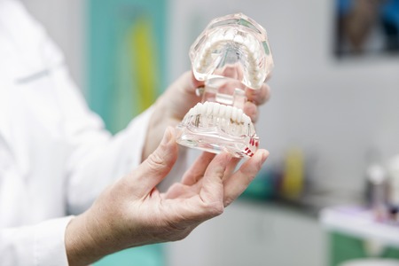 Female dentist holding in the hand dentures model