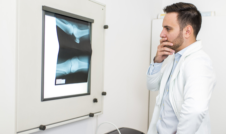 Young doctor analyzes the X-ray image at hospitalの写真素材