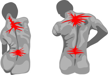 Painful female and male spineのイラスト素材