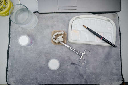 Production of dentures in a dental clinic.The process of creating dentures